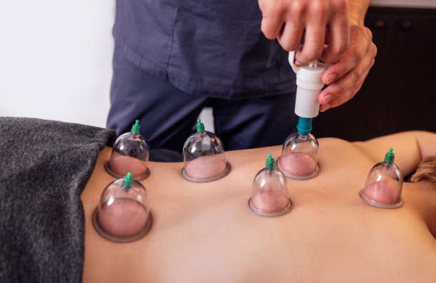 Cupping Therapy vs. Traditional Massage: Which is Right for You?